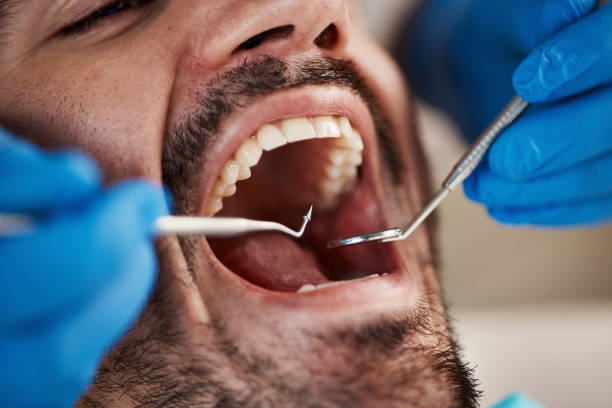Best Urgent Care for Lost Fillings or Crowns in Hydesville, CA